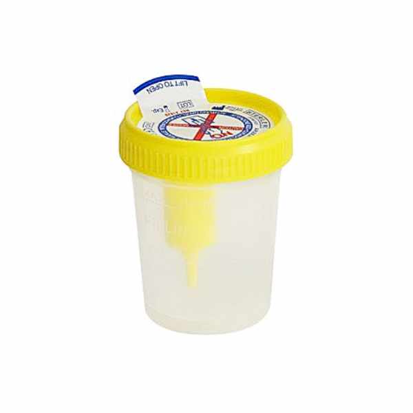 Urine cup, 120 ml, sterile - 200 pcs